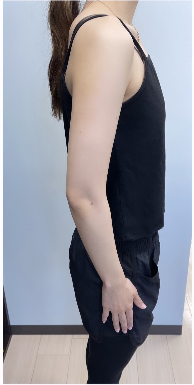 20代女性 ウェディングダイエット（3ヶ月） After