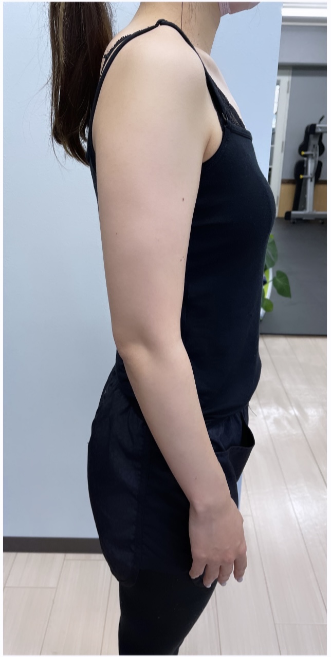 20代女性 ウェディングダイエット（3ヶ月） Before