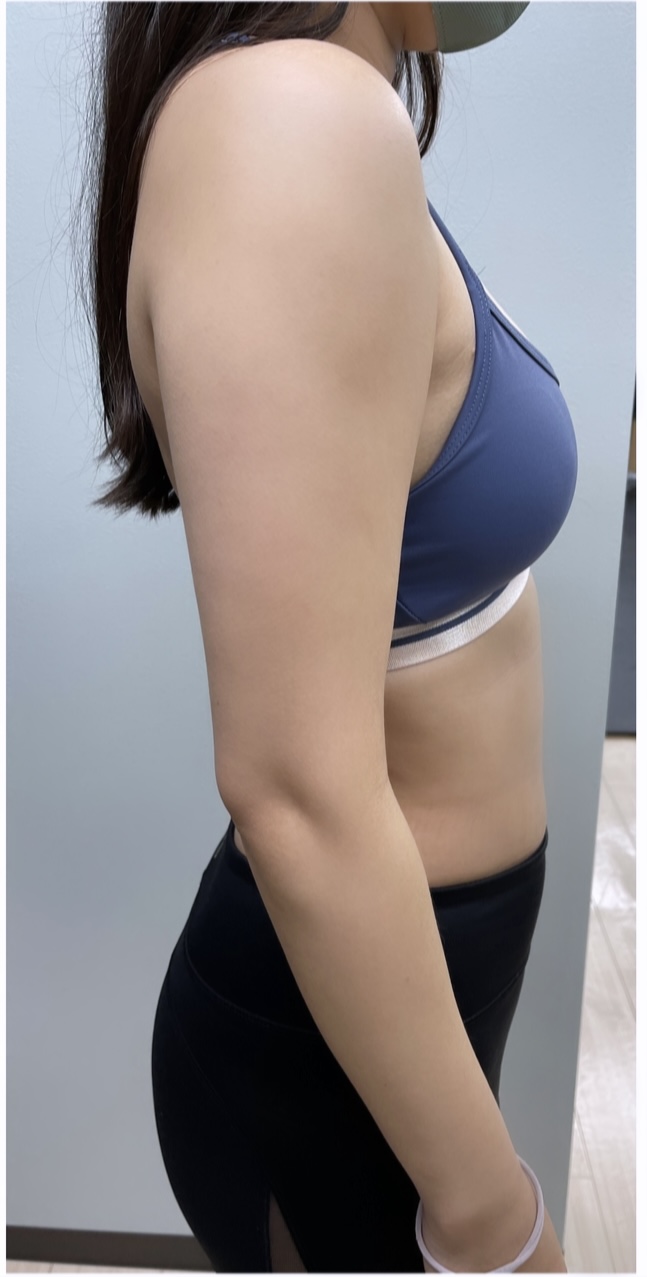 30代女性 ウェディングプラン（3ヶ月） Before