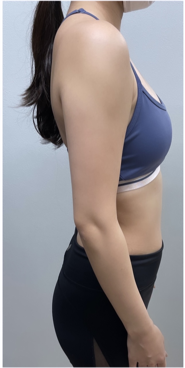 30代女性 ウェディングプラン（3ヶ月） After