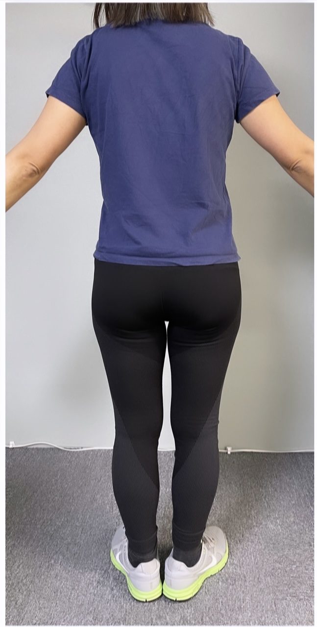 30代女性 産後ダイエット After