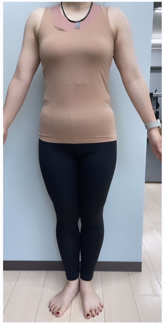 30代女性 産後トレーニング Before